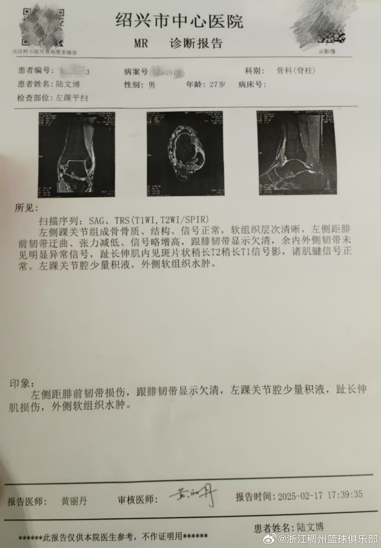 普利西奇的